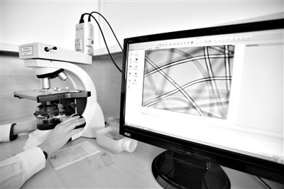 顯微鏡下，聚酯纖維很光亮，表面有斑點(diǎn)，粗細(xì)非常均勻。