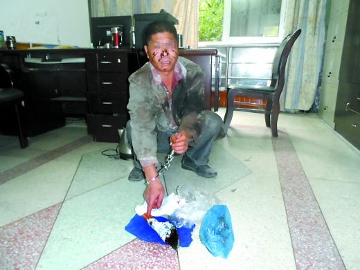   目前張遠已被刑事拘留。