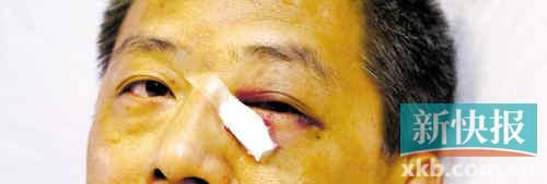 ■這起醫(yī)鬧事件，受傷的遠(yuǎn)遠(yuǎn)不只是熊旭明醫(yī)生的身體。