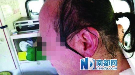 涉事教師遭熱水潑臉后的照片。