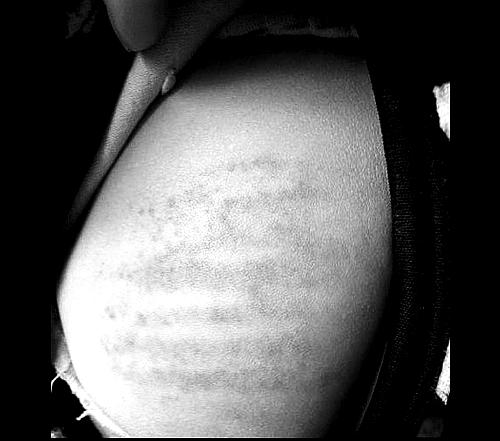 沒帶作業(yè)本 信陽潢川4歲娃兒遭老師輪番鞭打 沒帶作業(yè)本 信陽潢川4歲娃兒遭老師輪番鞭打