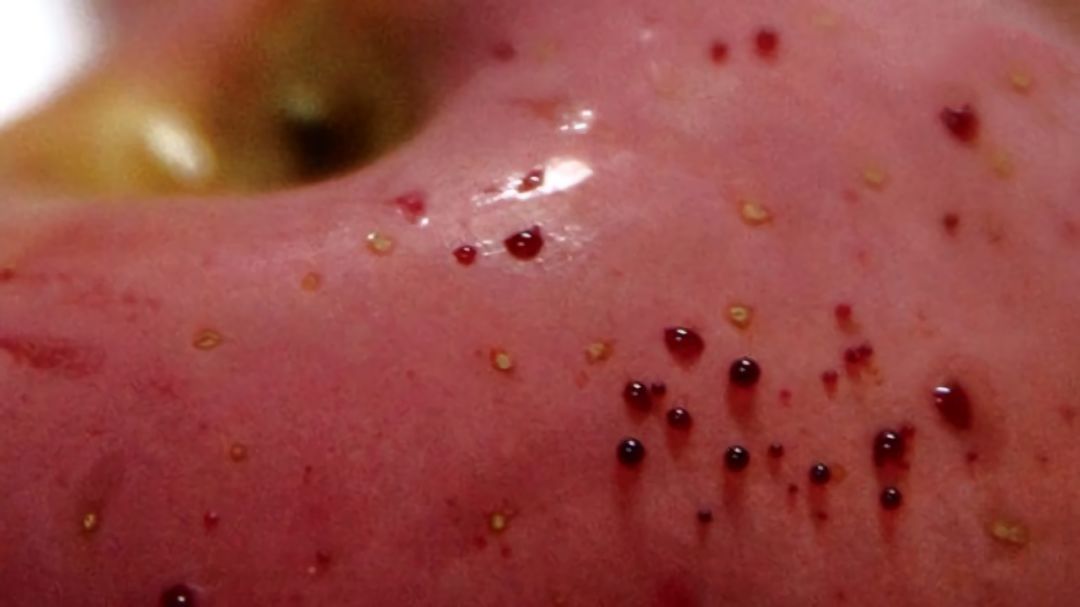 嚇懵！女子用熱水泡蘋果結(jié)果冒出血珠 咋回事？