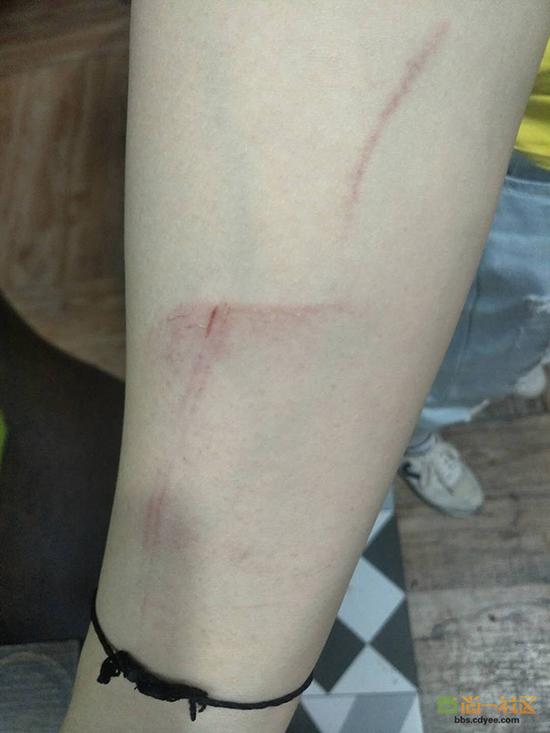 女網(wǎng)友舉報網(wǎng)帖中出示的被打后照片。