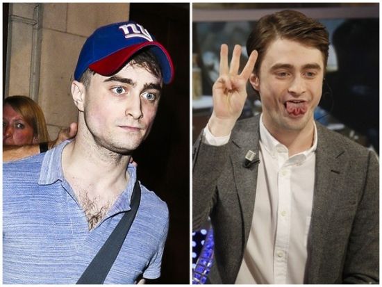 丹尼爾日前被拍到骨瘦如柴，不似2月份健康