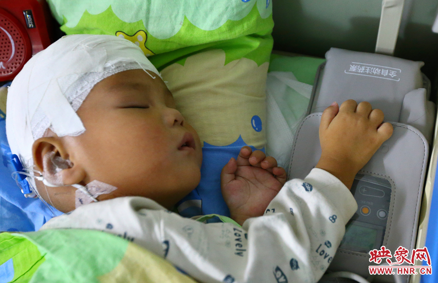 經(jīng)過手術(shù)，小龍病情已經(jīng)逐漸好轉(zhuǎn)，正在甜甜的熟睡