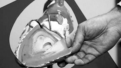 威廉斯領(lǐng)導(dǎo)的研究團(tuán)隊已經(jīng)利用人體脂肪干細(xì)胞，成功3D打印出心臟血管和心臟瓣膜，待一顆心臟的所有部件打