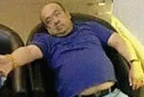 網(wǎng)傳金正男中毒后的照片。