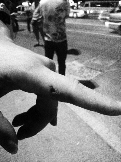 民警食指被咬傷。