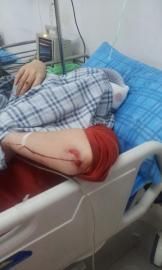 砸窗當(dāng)事人胡女士在醫(yī)院接受治療。