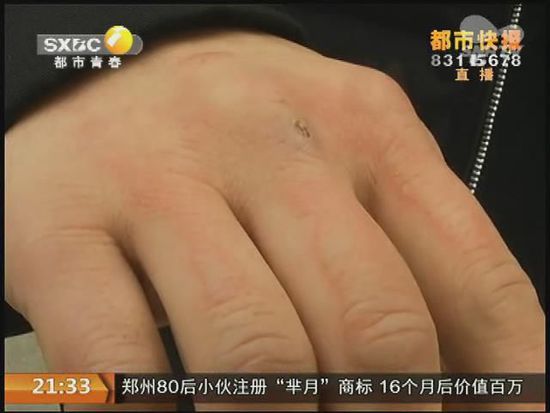 說到這足療拔罐，估計(jì)大伙都不陌生，但是想起4號晚上的拔罐的經(jīng)歷，呂先生現(xiàn)在想起來，還心有余悸。