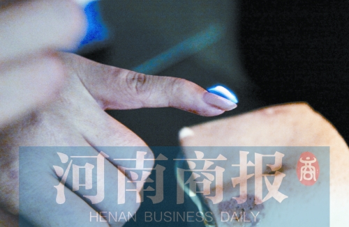 將指甲油涂在指甲上，靠近火焰時被引燃了