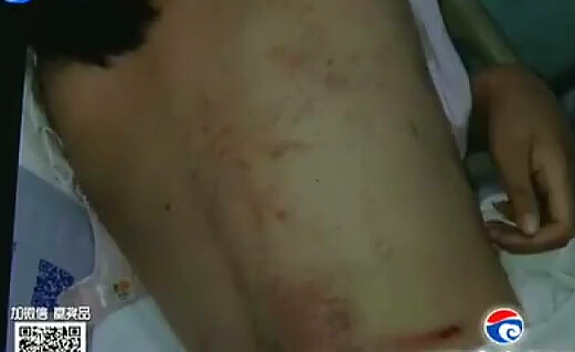 只因沒(méi)給同學(xué)買煙 大一女生被群毆昏迷