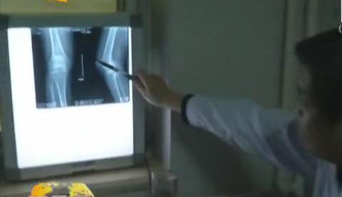 冷空氣來襲 如何預防老寒腿？